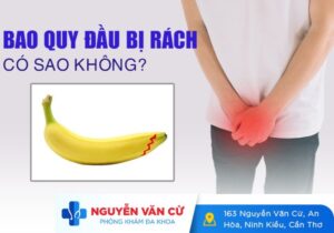 Bao Quy Đầu Bị Rách Có Nguy Hiểm Không?