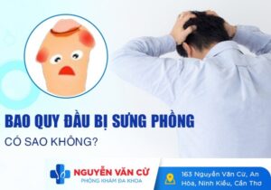 Bao Quy Đầu Bị Sưng Phồng Có Sao Không?