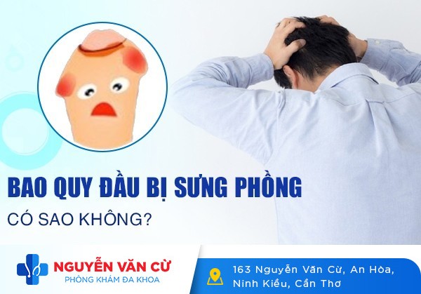 Bao Quy Đầu Bị Sưng Phồng Có Sao Không?