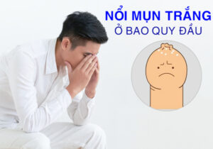 Nổi Mụn Trắng Ở Bao Quy Đầu Và Những Bệnh Lý Không Thể Bỏ Qua