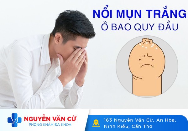 Nổi Mụn Trắng Ở Bao Quy Đầu Và Những Bệnh Lý Không Thể Bỏ Qua
