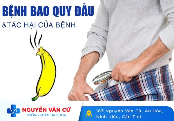 Bệnh Bao Quy Đầu Và Các Tác Hại Của Bệnh Bao Quy Đầu Ở Nam Giới