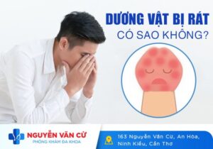 Dương Vật Bị Rát Có Nguy Hiểm Không?