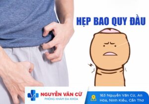 Tình Trạng Hẹp Bao Quy Đầu Ở Nam Giới