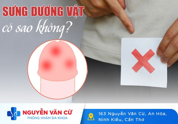 Dương Vật Bị Sưng Đau Có Nguy Hiểm Không?