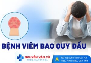 Một Số Hình Ảnh Viêm Bao Quy Đầu Ở Nam Giới