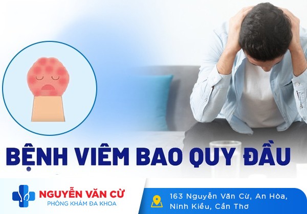 Một Số Hình Ảnh Viêm Bao Quy Đầu Ở Nam Giới