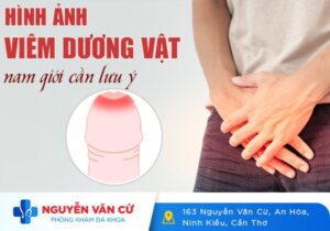 Hình Ảnh Viêm Dương Vật Nam Giới Cần Lưu Ý