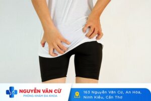 Áp Xe Hậu Môn Là Gì Dấu Hiệu Nhận Biết Và Cách Điều Trị