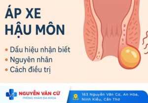 Áp xe Hậu Môn Nguy Hiểm Như Thế Nào?