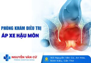 Chữa Áp Xe Hậu Môn Ở Đâu Cần Thơ Uy Tín Chất Lượng?