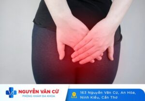Áp Xe Hậu Môn Là Bệnh Gì? Nguy Hiểm Như Thế Nào?