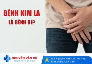 Bệnh Kim La Là Bệnh Gì? Dấu Hiệu Nhận Biết Bệnh Kim La