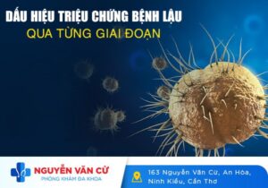 Dấu Hiệu Triệu Chứng Bệnh Lậu Qua Từng Giai Đoạn