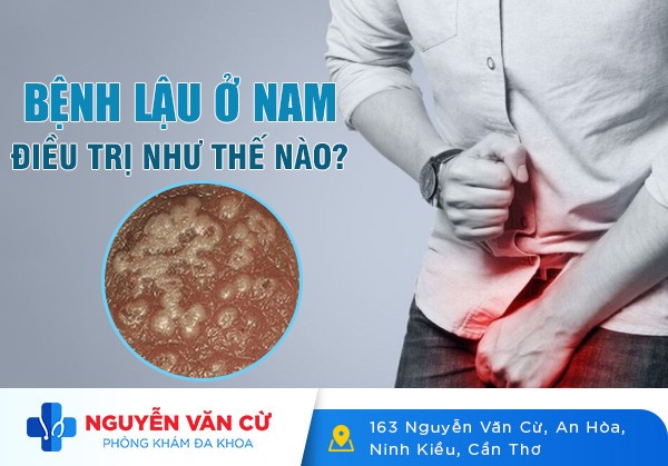 Bệnh Lậu Ở Nam Giới Điều Trị Như Thế Nào Hiệu Quả?