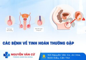 Một Số Bệnh Lý Tinh Hoàn Thường Gặp Ở Nam Giới