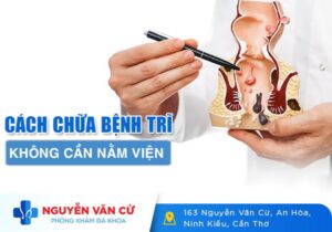 Cách Chữa Bệnh Trĩ Khỏi Ngay Không Cần Nằm Viện