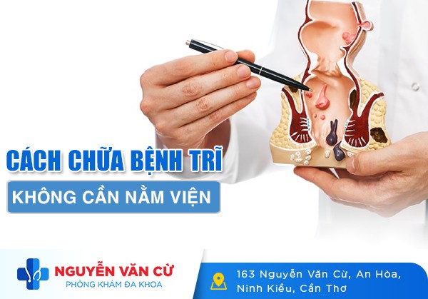 Cách Chữa Bệnh Trĩ Khỏi Ngay Không Cần Nằm Viện