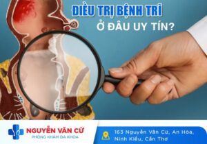 Điều Trị Bệnh Trĩ Ở Đâu Uy Tín Tại Cần Thơ?