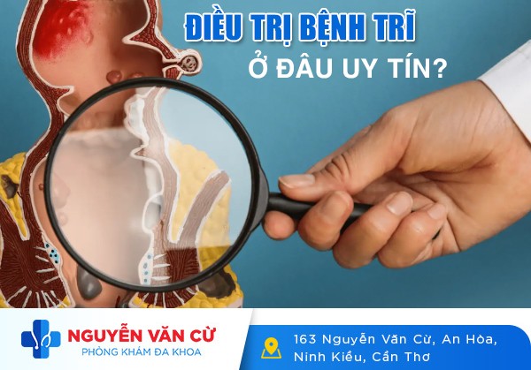 Điều Trị Bệnh Trĩ Ở Đâu Uy Tín Tại Cần Thơ?