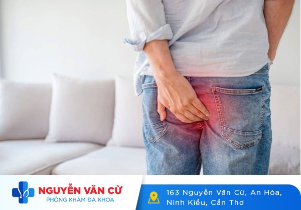 Tổng Quan Về Các Loại Bệnh Trĩ Cấp Độ 1