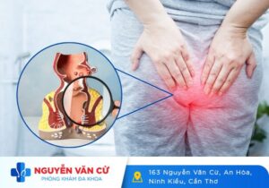 Bệnh Trĩ Nội Là Gì? Triệu Chứng Và Cách Chữa Trị Bệnh Trĩ
