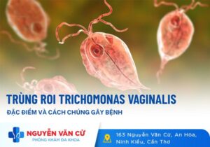 Bệnh Trùng Roi Là Bệnh Gì? Dấu Hiệu Nhận Biết Và Cách Điều Trị