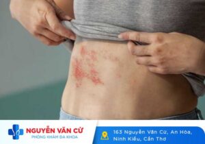 Nhận Biết Triệu Chứng Các Bệnh Truyền Nhiễm Lây Qua Đường Tình Dục