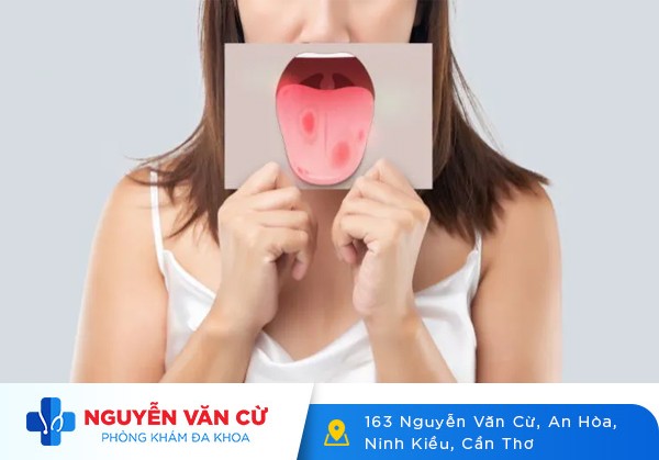 Nhận Biết Dấu Hiệu Của Các Loại Bệnh Xã Hội Thường Gặp Và Phương Pháp Điều Trị