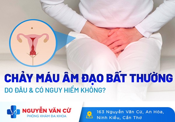 Bác Sĩ Giải Đáp Chảy Máu Âm Đạo Bất Thường Nguy Hiểm Như Thế Nào?