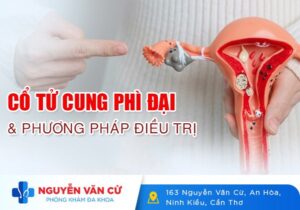 Cổ Tử Cung Phì Đại Và Phương Pháp Điều Trị Hiệu Quả
