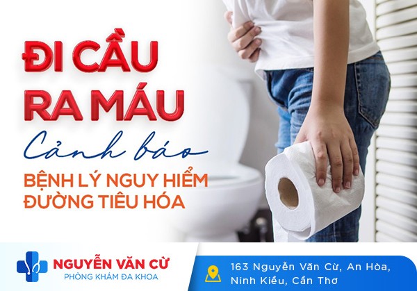 Đi Cầu Ra Máu Là Dấu Hiệu Của Bệnh Gì?