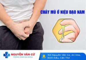 Chảy Mủ Ở Niệu Đạo Đường Tiết Niệu Là Dấu Hiệu Của Bệnh Gì? Có Nguy Hiểm Không?