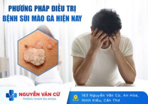 [Tổng Hợp] Các Phương Pháp Điều Trị Bệnh Sùi Mào Gà Hiện Nay