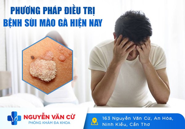 [Tổng Hợp] Các Phương Pháp Điều Trị Bệnh Sùi Mào Gà Hiện Nay