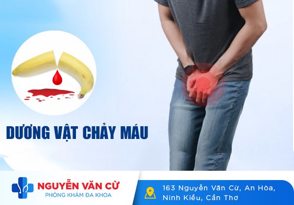 Dương Vật Chảy Máu Dấu Hiệu Của Những Bệnh Gì?