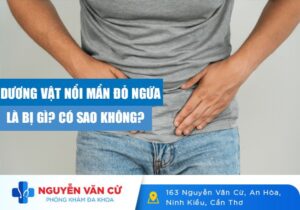 Nổi Mẩn Đỏ Ngứa Ở Nam Giới, Dấu Hiệu Không Nên Xem Thường