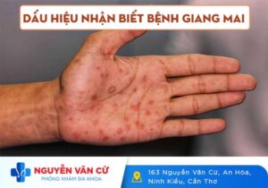 Dấu Hiệu Nhận Biết Bệnh Giang Mai Ở Nam Và Nữ
