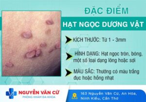 Hình Ảnh Hạt Ngọc Dương Vật Và Cách Trị