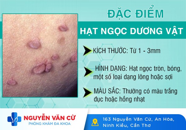Hình Ảnh Hạt Ngọc Dương Vật Và Cách Trị