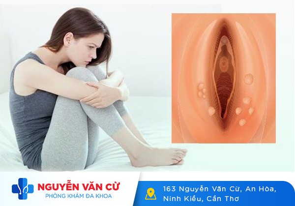 Hình Ảnh Sùi Mào Gà Ở Nữ Giới Qua Từng Giai Đoạn