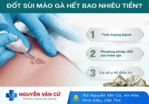 Chi Phí Đốt Sùi Mào Gà Là Bao Nhiêu?