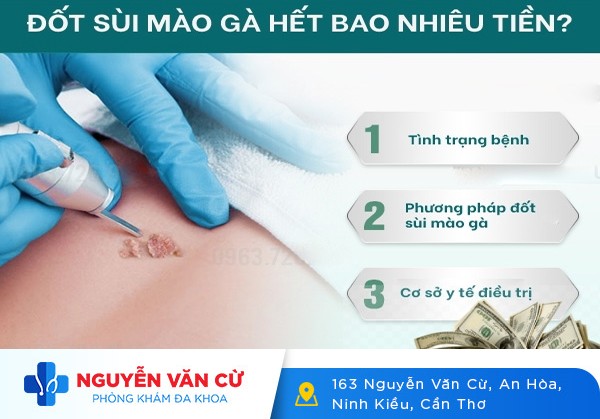 Chi Phí Đốt Sùi Mào Gà Là Bao Nhiêu?