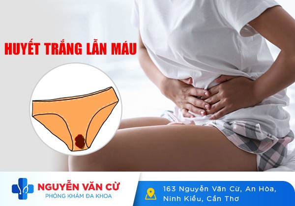 Huyết Trắng Có Lẫn Máu Là Mắc Bệnh Gì?