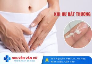 Khí Hư Bất Thường Là Gì? Nguyên Nhân Và Cách Khắc Phục
