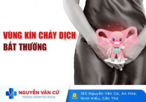 Vùng Kín Chảy Dịch Bất Thường