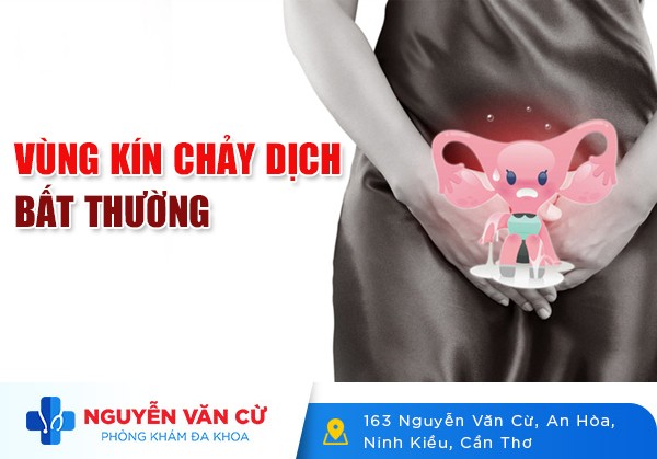Vùng Kín Chảy Dịch Bất Thường