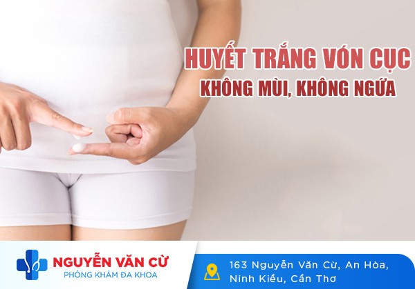 Giải Mã Huyết Trắng Vón Cục Không Mùi Không Ngứa