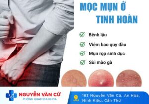 Nổi Mụn Ở Tinh Hoàn Là Mắc Bệnh Gì?
