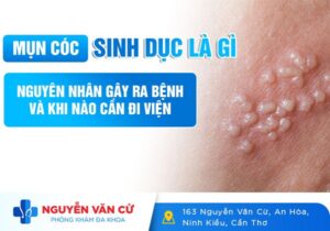 Mụn Cóc Sinh Dục Là Gì Dấu Hiệu Nhận Biết Và Phương Pháp Điều Trị